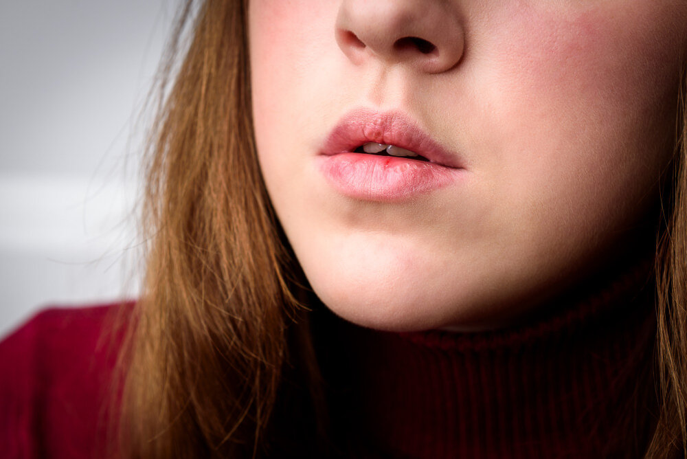 Что делать, чтобы не сохли губы? 4 совета врача-косметолога
