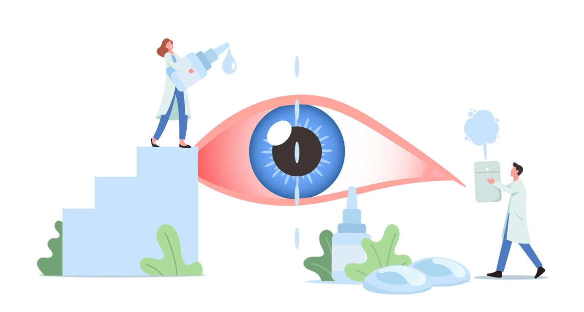 Синдром сухого глаза: симптомы и лечение