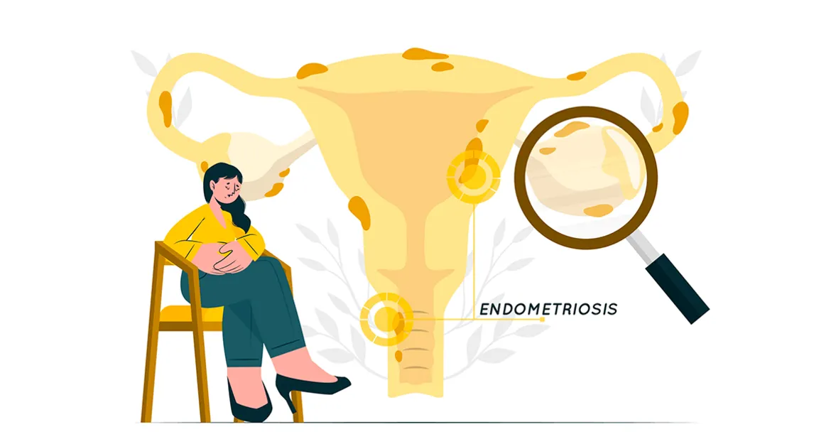 Як розпізнати хронічний ендометрит: підказки, які дає організм