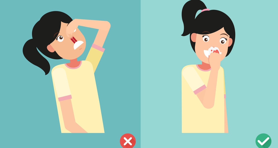 Носовое кровотечение - причины, что делать, как остановить кровь из носа