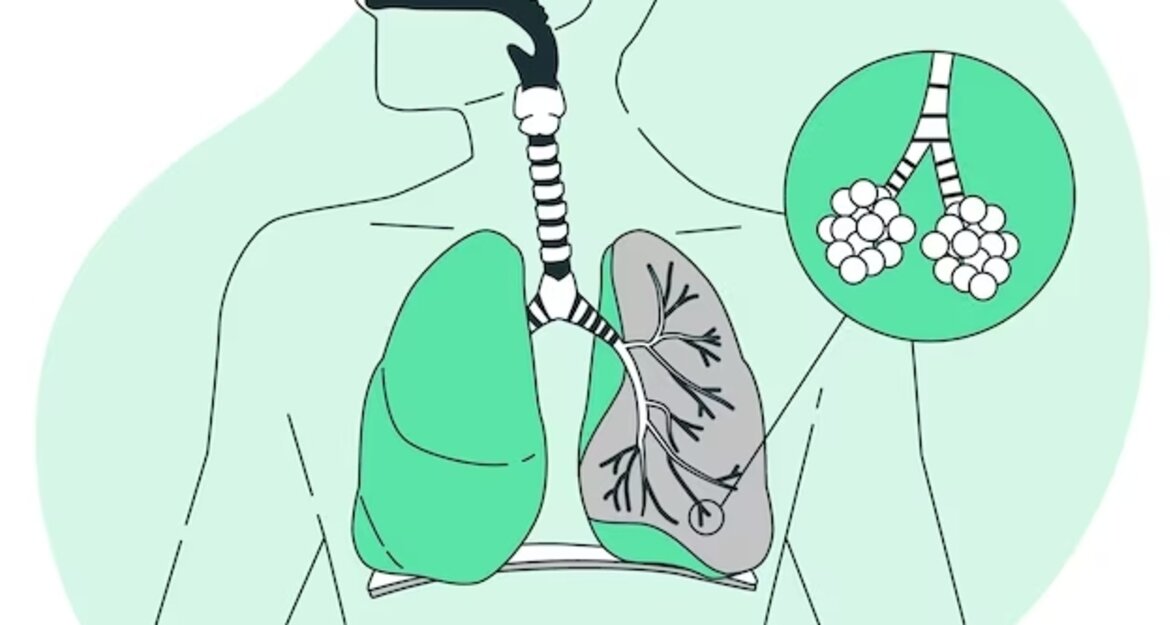 Бронхіальна астма: що це, причини, симптоми, лікування і профілактика