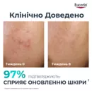 Юцерин (Eucerin) ДермоПьюр сыворотка комплексной коррекции для проблемной кожи лица 40 мл — Фото 22