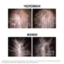 Віши (Vichy) Деркос Амінексил Клінікал Ріджен сироватка для волосся 90 мл — Фото 10