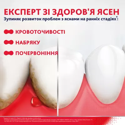 Зубная паста Пародонтакс (Parodontax) Без фтора 75 мл — Фото 3