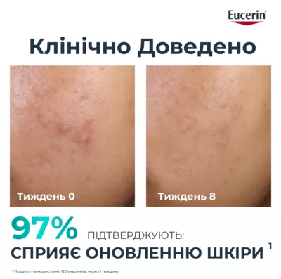 Юцерин (Eucerin) ДермоПьюр сыворотка комплексной коррекции для проблемной кожи лица 40 мл — Фото 11