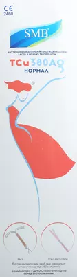 Внутрішньоматковий протизаплідний засіб з міддю SMB TСu 380 Плюс Нормал з матковим зондом — Фото 3