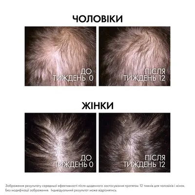 Віши (Vichy) Деркос Амінексил Клінікал Ріджен сироватка для волосся 90 мл — Фото 3