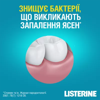 Ополіскувач для порожнини рота Лістерин (Listerine) Свіжа м'ята 250 мл — Фото 5