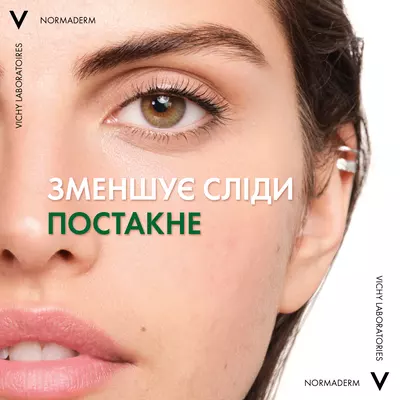 Виши (Vichy) Нормадерм Пробио сыворотка-пилинг для коррекции недостатков жирной и проблемной кожи лица 30 мл — Фото 5