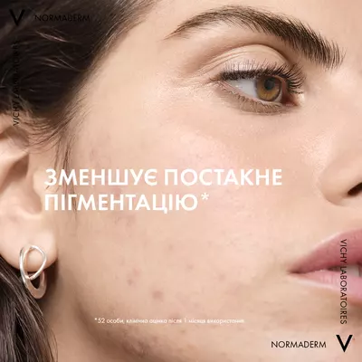 Віши (Vichy) Нормадерм гель-сироватка очищувальний з ефектом пілінгу 125 мл — Фото 4