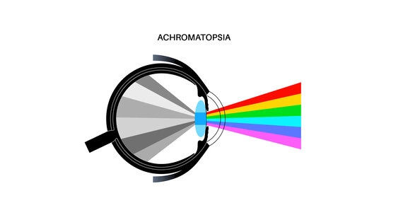 Дальтонізм: чому виникає колірна сліпота, види та профілактика