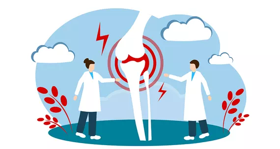 Суглоби взимку: біль, набряки, загострення – як допомогти собі?