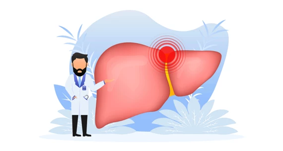 Хвороби печінки: як визначити, що болить саме вона?