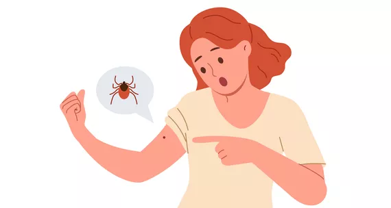 Перша допомога, якщо вкусив кліщ
