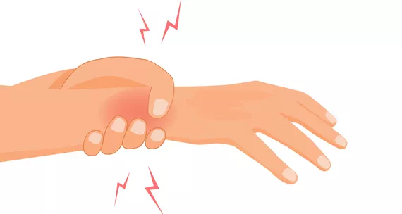Синдром зап’ястного каналу – коли біль і оніміння в руках не варто ігнорувати 