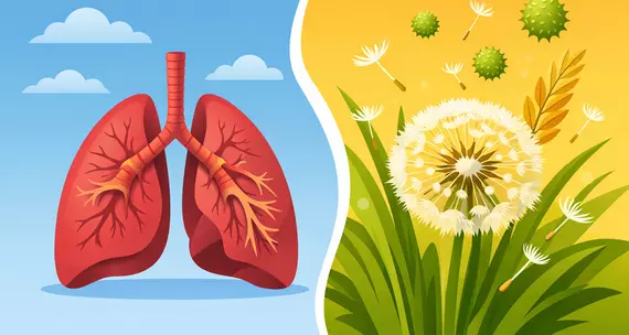 Бронхіальна астма і сезонна алергія – який зв’язок?