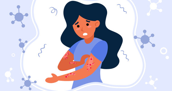 Распространенные кожные заболевания и как их лечить с помощью безрецептурных препаратов