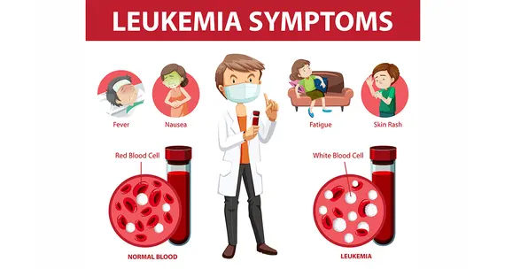 Лейкемии: опасные изменения в крови, которые часто остаются незамеченными