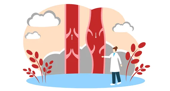 Что такое тромбофилия и чем она опасна?