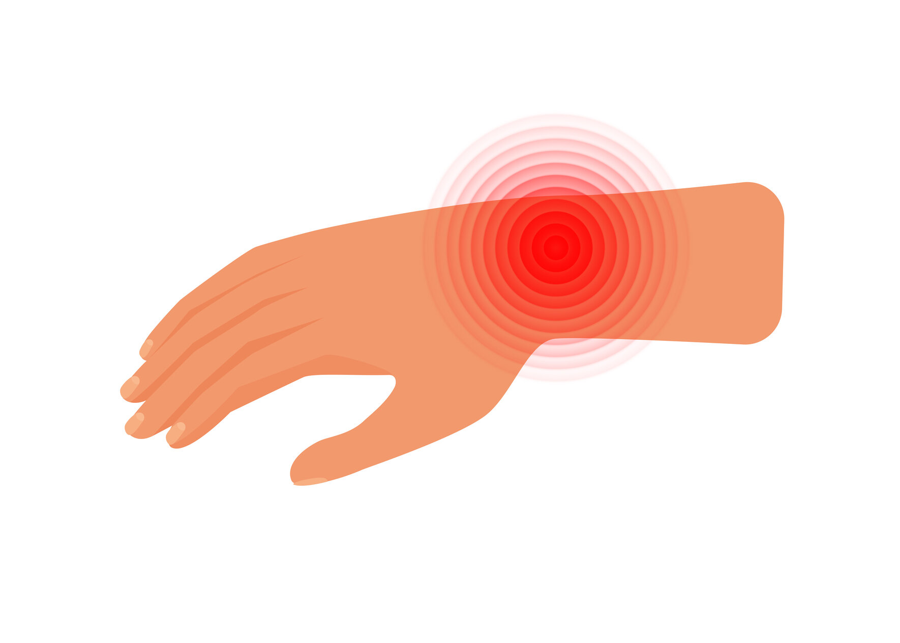 Синдром зап’ястного каналу – коли біль і оніміння в руках не варто ігнорувати 