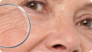 Антивозрастной уход